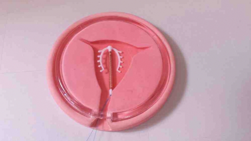 Modelo Uterino 